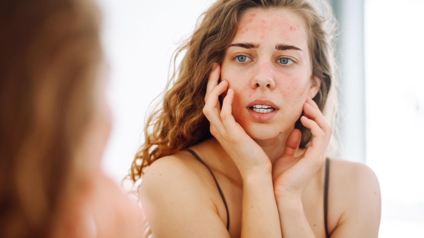 7 Costumes Que Acabam Com Sua Pele