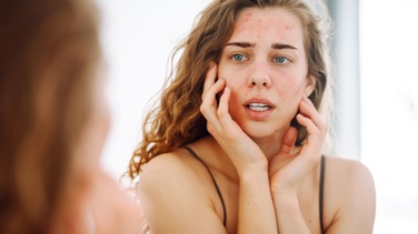 7 Costumes Que Acabam Com Sua Pele